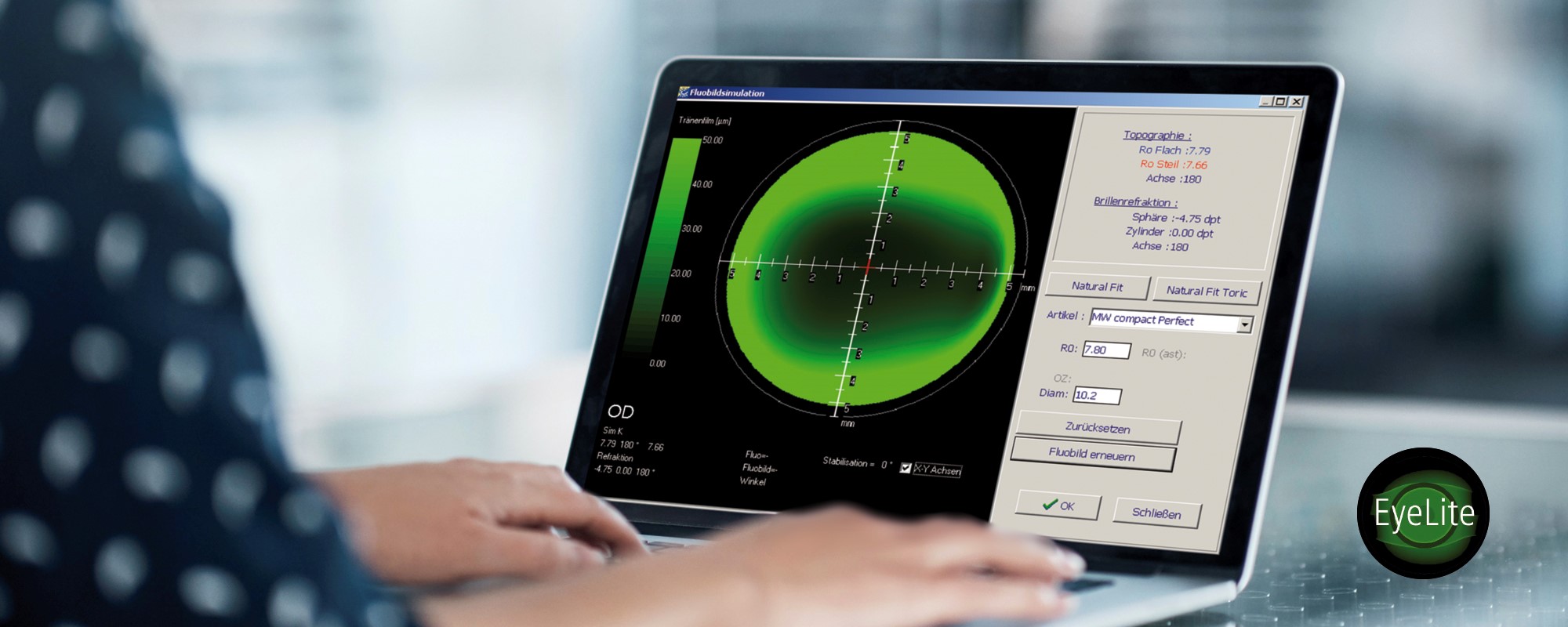 Bild zu EyeLite: kostenlose Anpass-Software von MPG&E